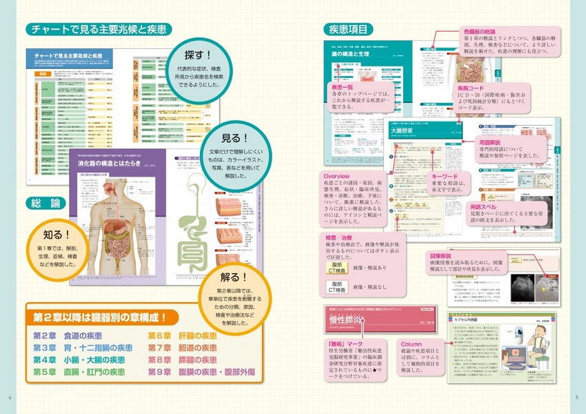 胃食道逆流症（GERD）